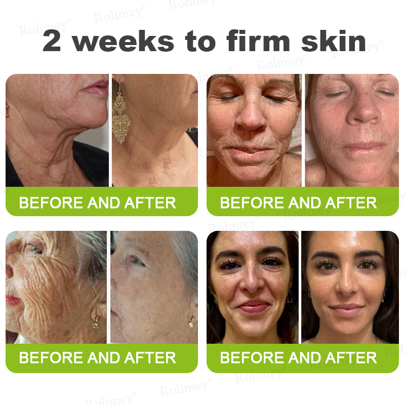 RapidLift™ Instant-Firming Peptide & Retinol Serum
