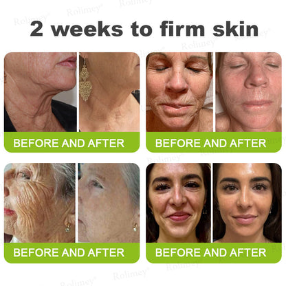 RapidLift™ Instant-Firming Peptide & Retinol Serum
