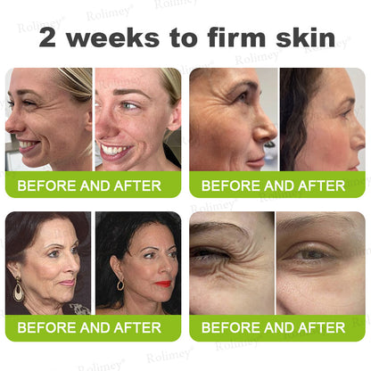 RapidLift™ Instant-Firming Peptide & Retinol Serum