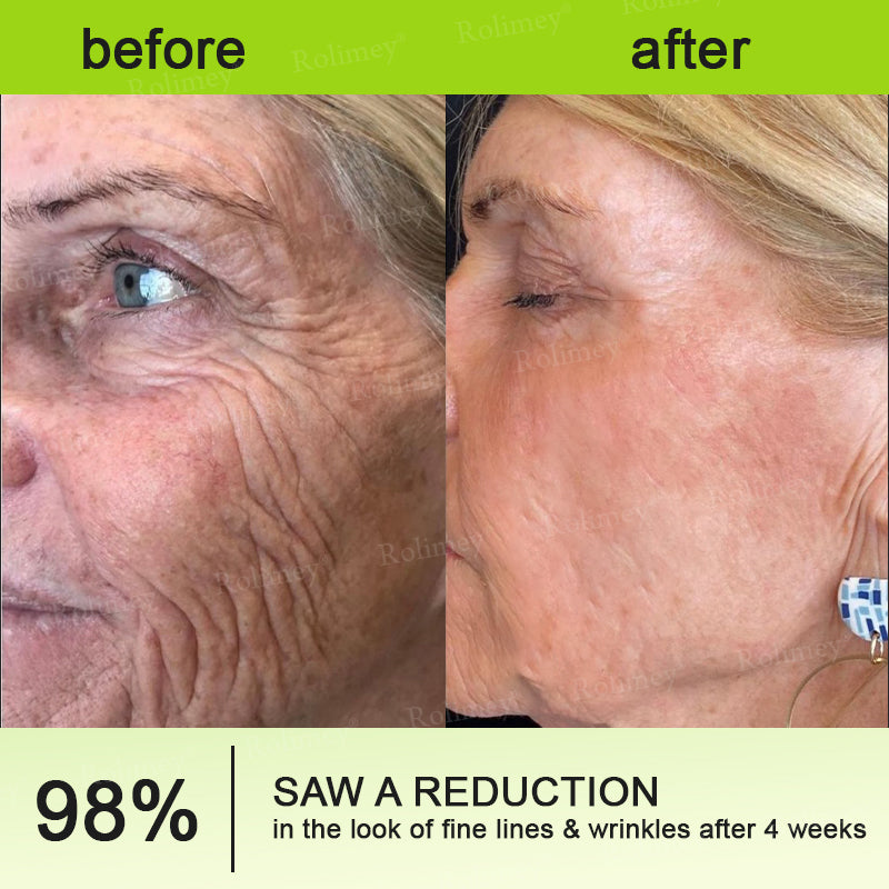 RapidLift™ Instant-Firming Peptide & Retinol Serum