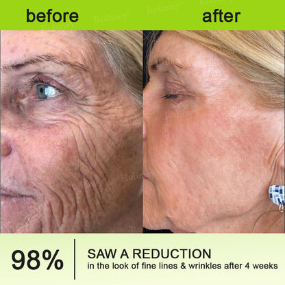 RapidLift™ Instant-Firming Peptide & Retinol Serum