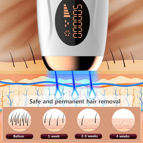 GlowPro™ IPL Laser Hair Removal Device