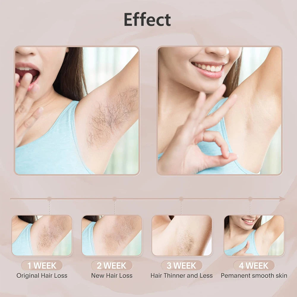 GlowPro™ IPL Laser Hair Removal Device