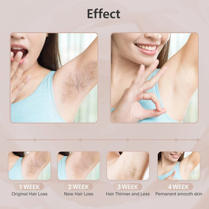 GlowPro™ IPL Laser Hair Removal Device